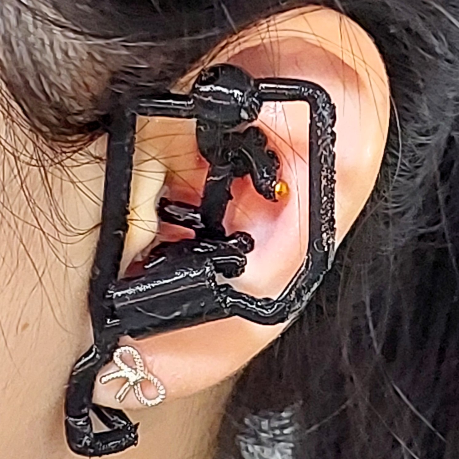 Incorrect fit - front view