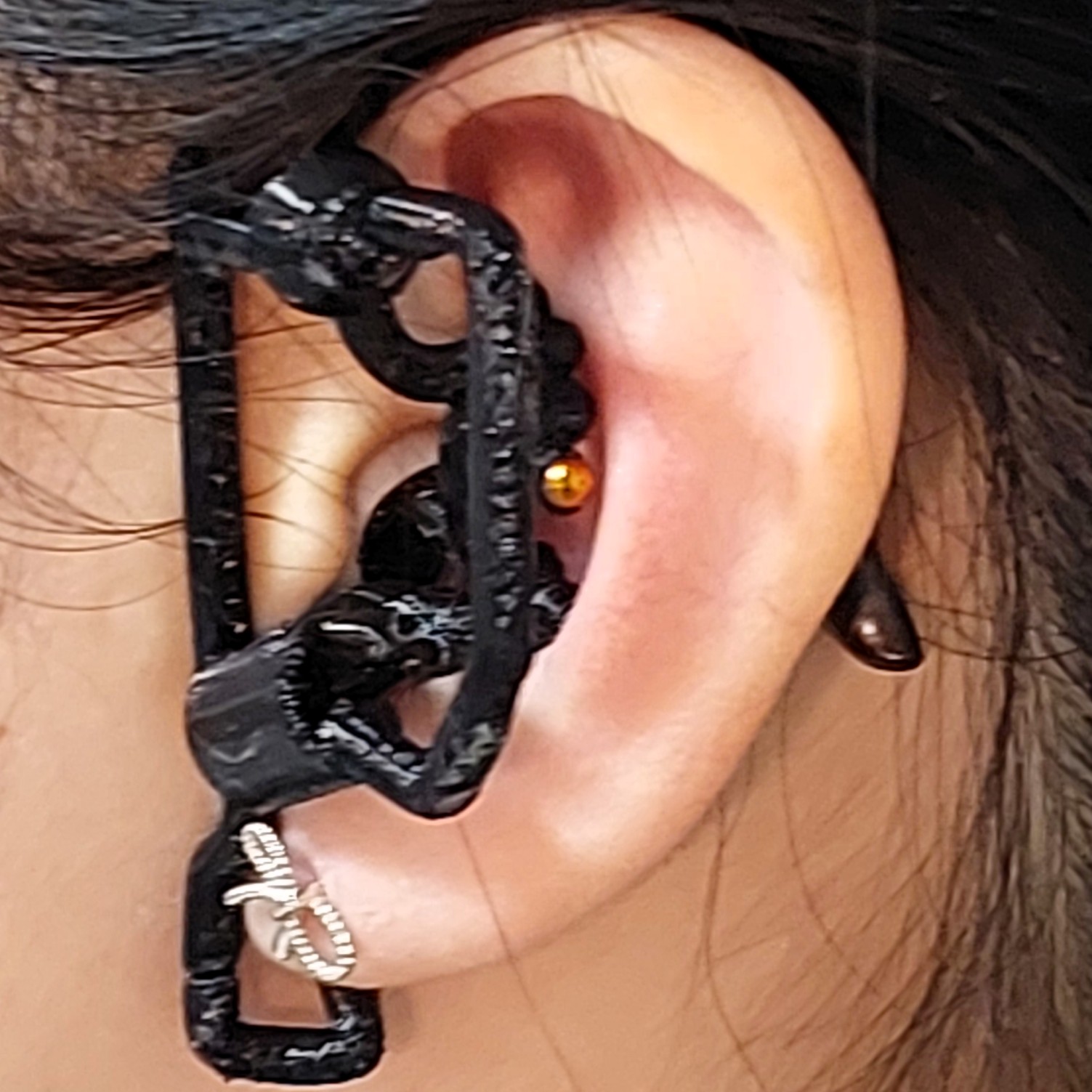 Incorrect fit - side view