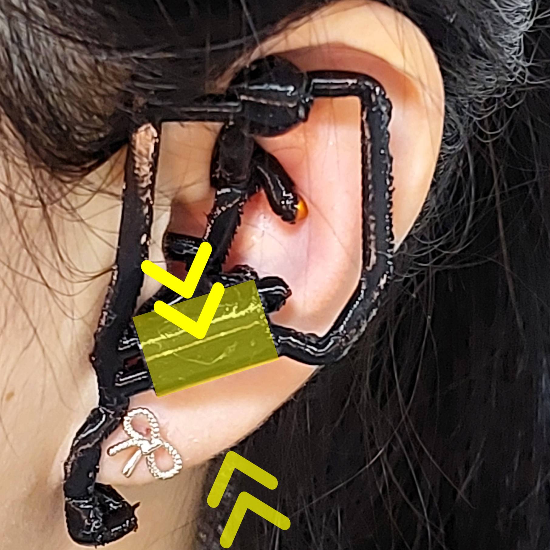 Booster 3 — pinch broad plate